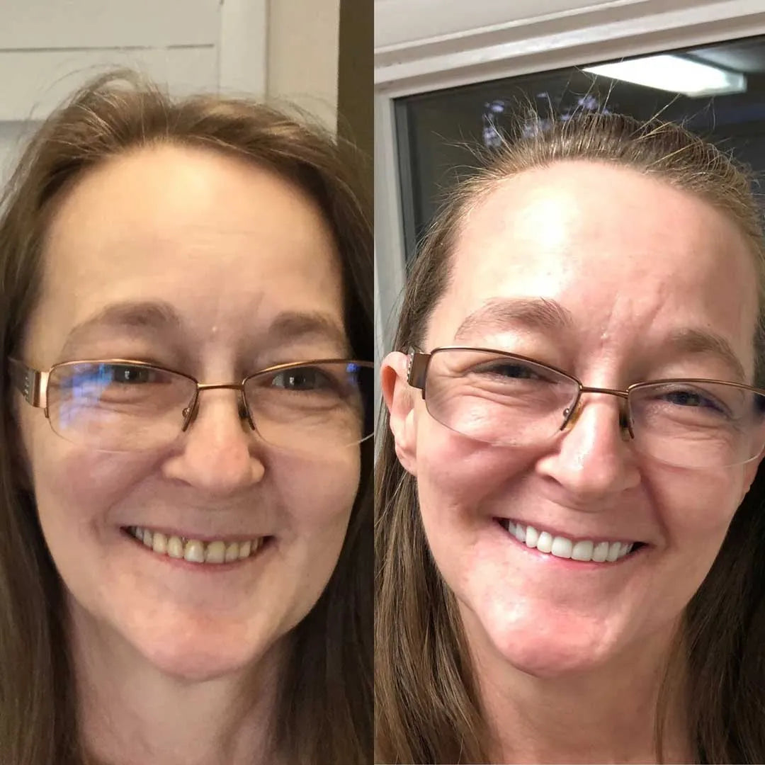 Dentra™ Klæbemiddel | Den termoplastiske proteseklæber, der holder dine tænder fast i 4 dage uden at svigte.