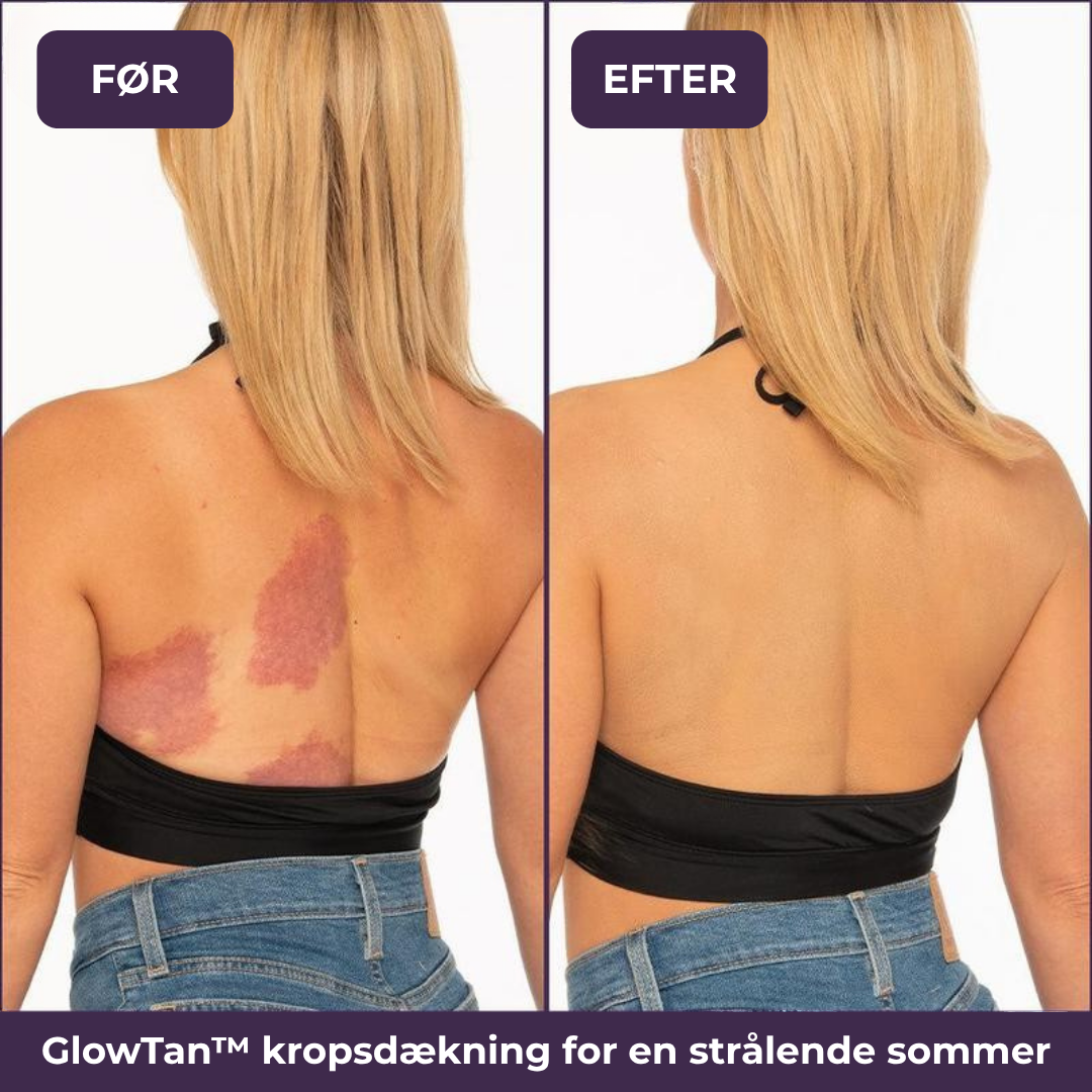 GlowTan™ | Den perfekte creme til hele kroppen!