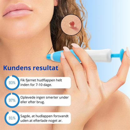 TagClear™ | Smertefri fjernelse af hudmærker