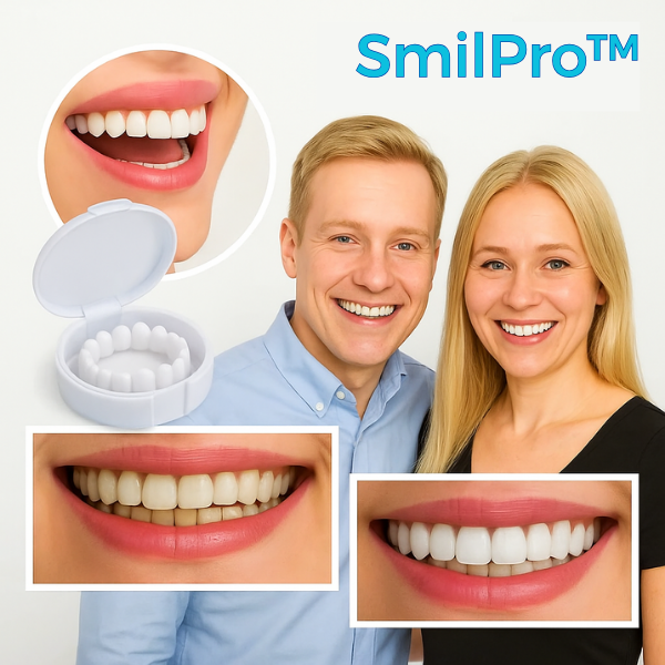SmilPro™ Tandfacader | Smukke hvide tænder på kun 60 sekunder!