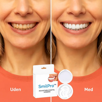 SmilPro™ Tandfacader | Smukke hvide tænder på kun 60 sekunder!