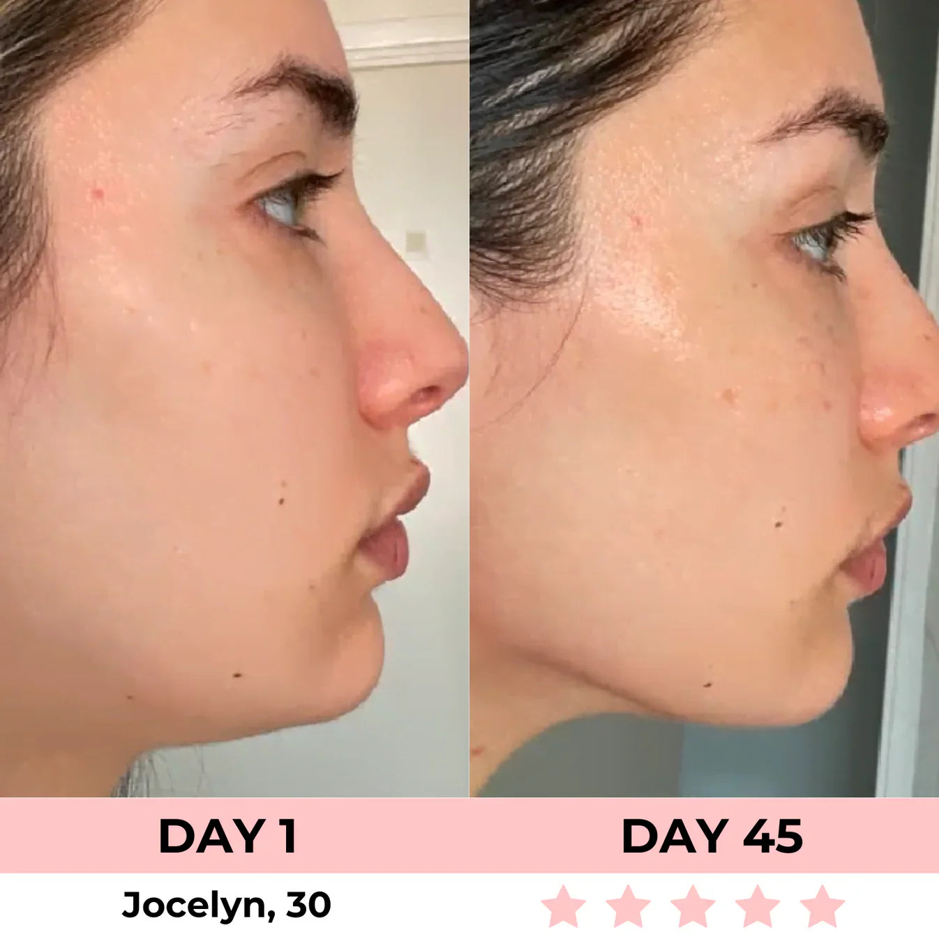 Luminora™ 7-in-1 LED Facial Sculptor | Strammere, glattere, jævn og klar hud på 10 minutter.