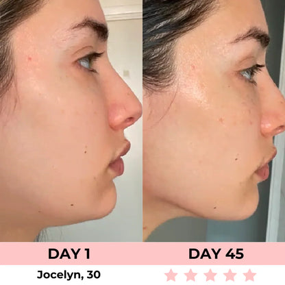 Luminora™ 7-in-1 LED Facial Sculptor | Strammere, glattere, jævn og klar hud på 10 minutter.